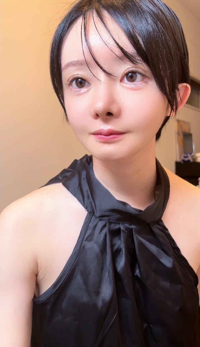 y_seikeiol's tweet photo. NANAのオトガイ形成2ヶ月！！

いきなり顎小さくなってきて感動🥺
まだチュンとした輪郭はないけど台形顎からは解放された。

ただ拘縮が始まって喋る時に突っ張る💦
早く引いてくれ🙏 https://t.co/wFqTZhiZvs