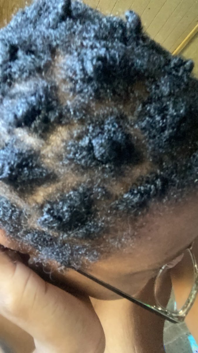 lyndaaax2's tweet photo. First stage of growth lol https://t.co/Mx447tcO73