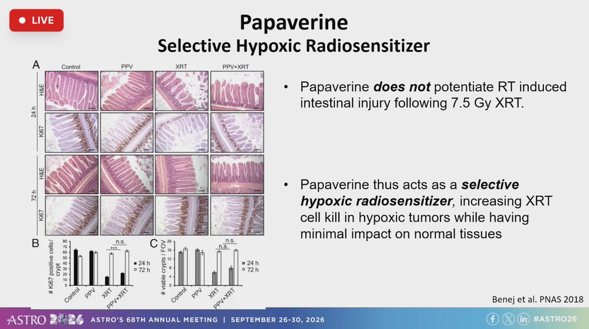 DrewMoghanaki's tweet photo. New clinical trial data from Jeremy Brownstein evaluating a hypoxic radiosensitizer in combination with lung SBRT. #ASTRO26 1/ https://t.co/P30Nj4JsOf