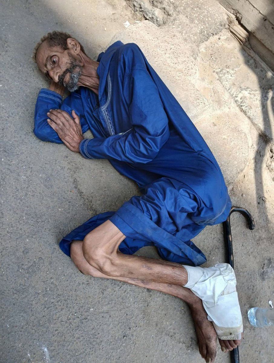 m78203's tweet photo. Bombardıman başlamadan önce bile açlık bedenlerini harap ediyordu.

Açlıktan ve hastalıktan bitkin düşmüş yaşlı bir Filistinli adam kaldırımda yatıyor, zayıflamış bedeni kalkamıyor, yaralı bacağı yırtık bir bandajla sarılı. https://t.co/P2R268imNe