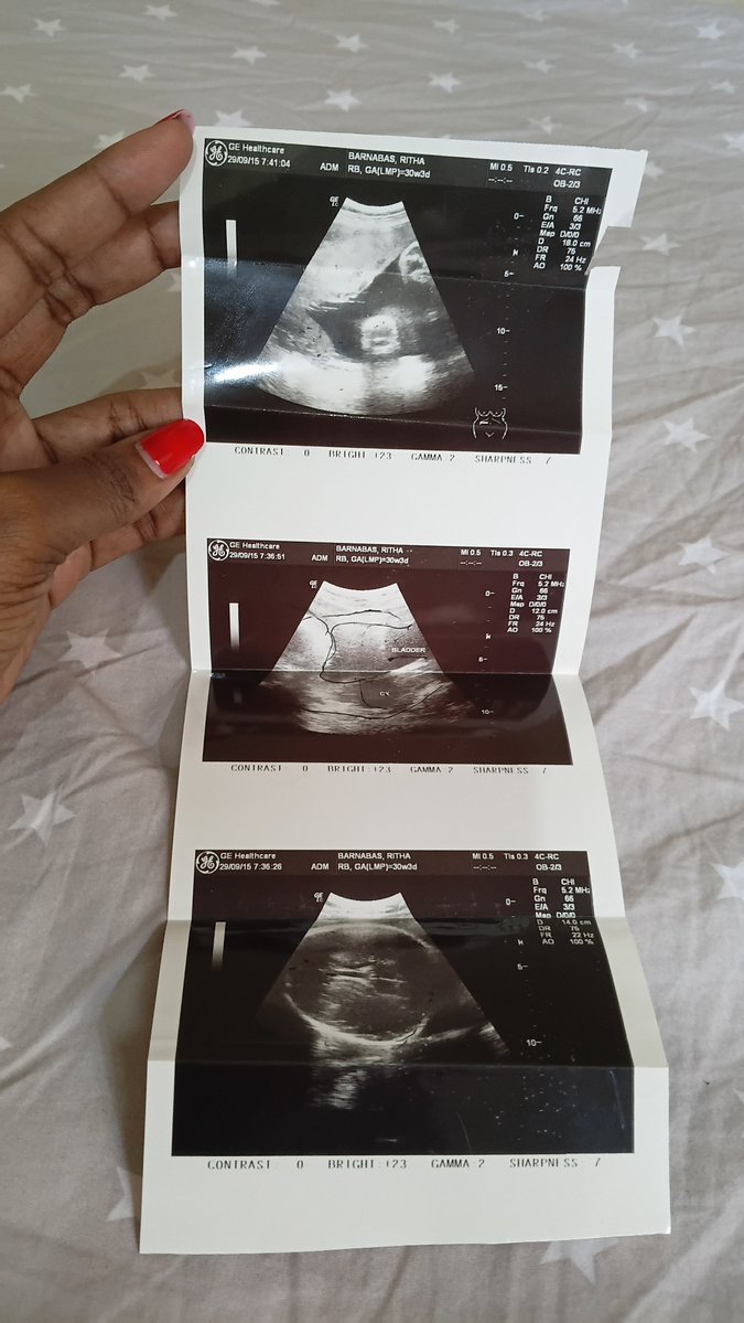 msritha_'s tweet photo. Wheeeew! It was 29.9.2015 the baby was growing inside me... 11 yrs ago 
Hii ya pili nahisi Roho Mtakatifu atashuka kama alivyomshukia Maria 😂 https://t.co/ynRzmTM5ar