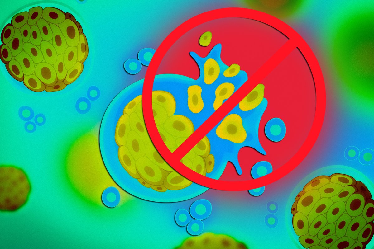 Vasilisa_Orlov's tweet photo. Most colon cancer deaths come from metastasis, often to the liver. MIT researchers found YAP1, a tissue-repair pathway, drives this spread—and high-fat diets can switch it on via ceramides.
https://t.co/EGG0hwG8oG https://t.co/CEuBLPGVjZ