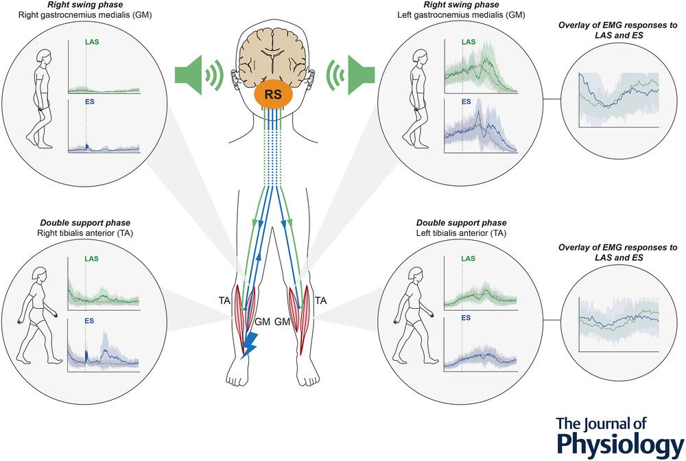 JPhysiol's tweet photo. In this study, Nicole Sarah Holliger (@derbalgrist) and collaborators investigated the involvement of the #reticulospinal system in the control of #locomotion 🧠 🔊 

Read the paper👇️ 
https://t.co/cvsj5cMYyf https://t.co/SGTWuGD0OG