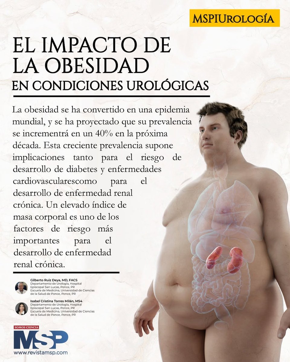 RevistaMSP's tweet photo. #MSPUrología | Obesidad y salud urológica: una relación que debemos conocer. 🩺
Lee el artículo completo aquí: https://t.co/9Q0sW8RDgk
#MSP: El lugar donde médicos, pacientes y profesionales de la salud pueden entrar.
#SomosCiencia https://t.co/PyWQefBcuH