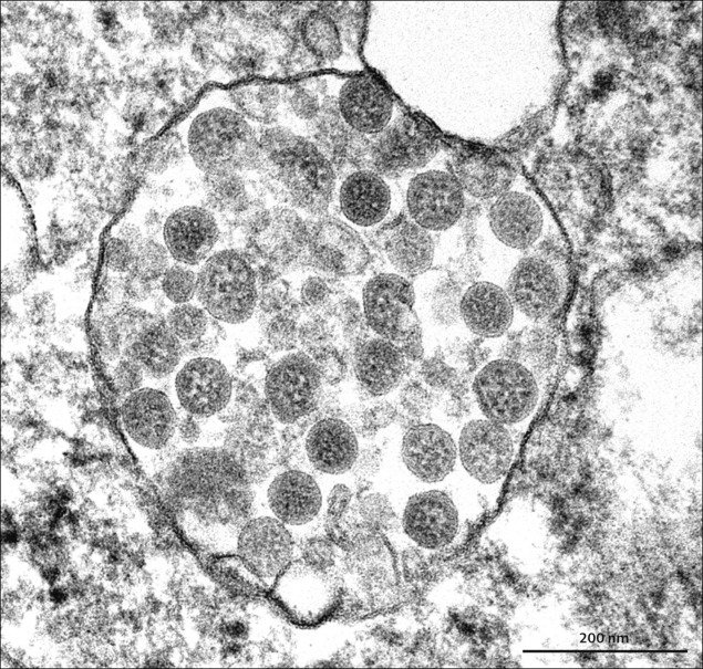 IanCopeland5's tweet photo. Antivaxers: COVID-19 wasn't real. There is no evidence that it, or any other virus are real or infect cells.

Me: Right, right. Completely unrelated, here is COVID-19 under a microscope infecting a cell...

https://t.co/hrJ24YAHYO https://t.co/8YAurmyMXo