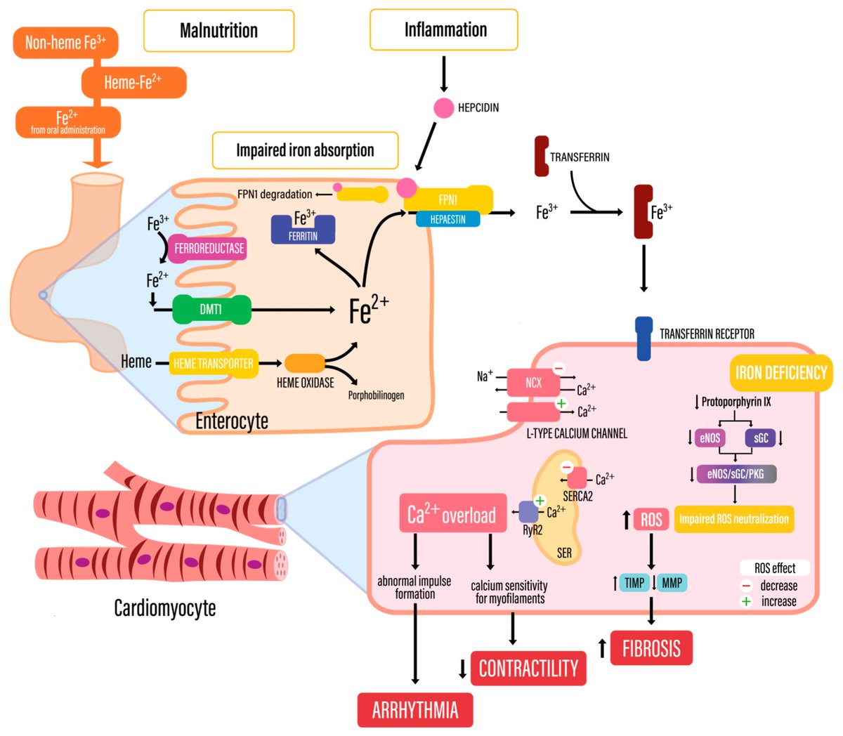 Biomed_MDPI's tweet photo. 🫀Iron deficiency in acute coronary syndromes is linked to worse outcomes, lower exercise capacity, and more hospital readmissions. Emerging evidence suggests supplementation may also be associated with reduced myocardial scarring.💉 #AcuteCoronarySyndrome
https://t.co/qcO16taBxG https://t.co/SL21MAx78m