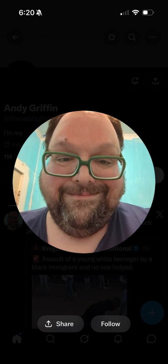 NazisRuglyfags's tweet photo. @TherealEggFarts @NikkiCoffee77 What the fuck is that https://t.co/HU0tla1lum