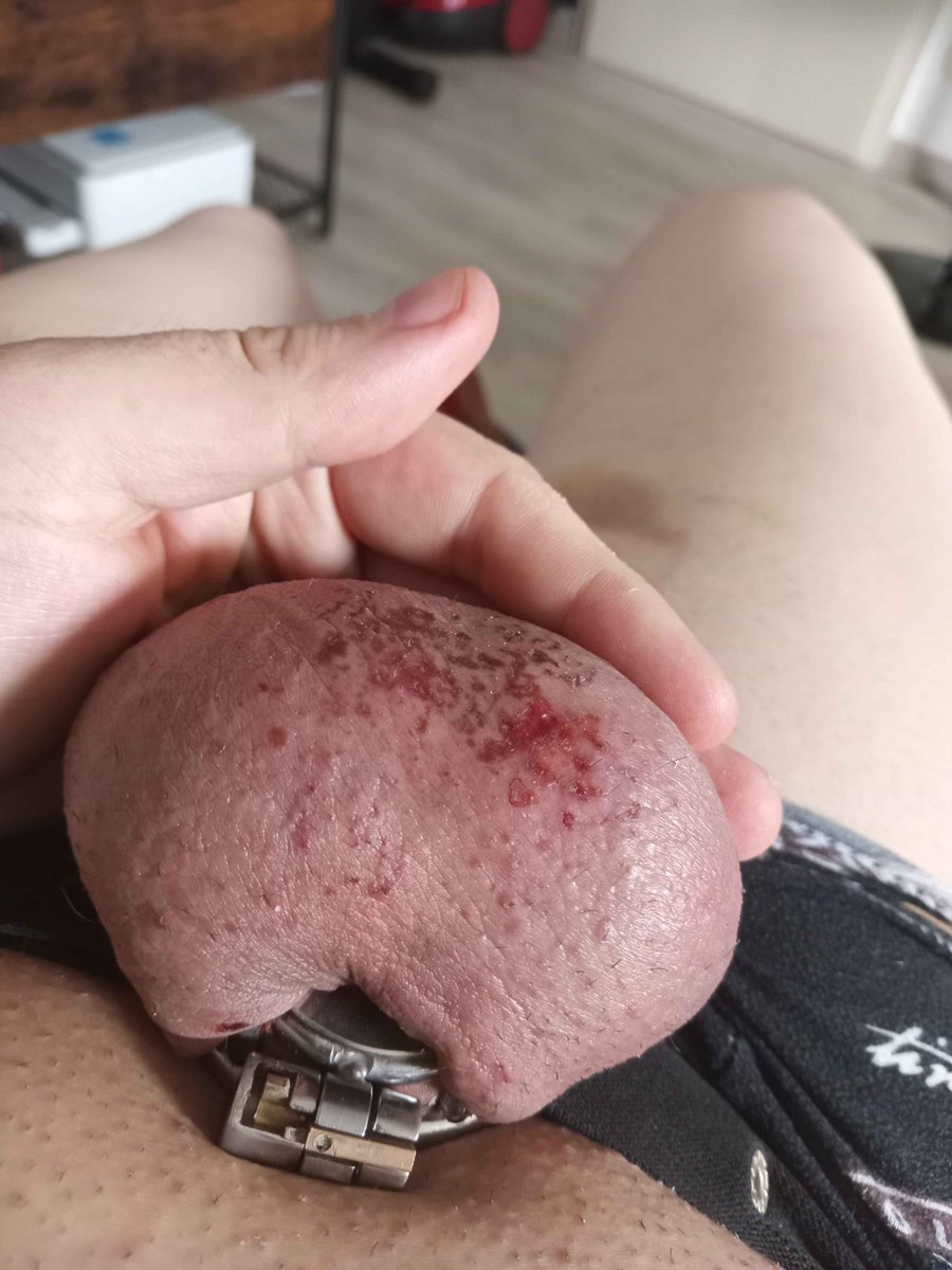 caged_ruby8585's tweet photo. Hehe look at what I did to this cucks orbs wouldn't you just lobe to be like him 

#KAW #WLDM #WLS #OBLM https://t.co/I7Zta5U80l