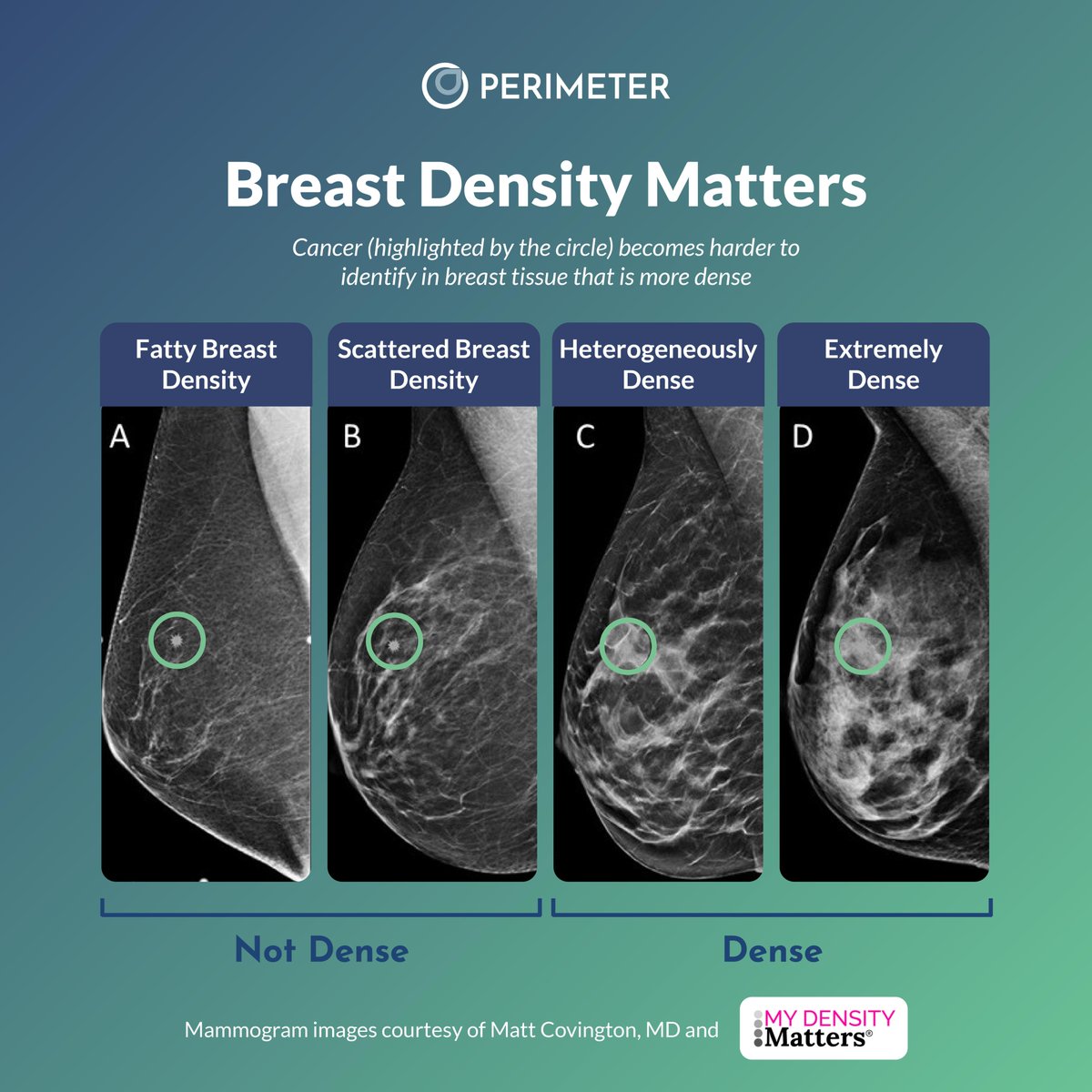 PerimeterMed's tweet photo. Your Breast Density Matters, Here's Why:
When dense breast tissue is imaged on a standard mammogram, it appears white. So does cancer.
If you have dense breasts, talk with your doctor about advanced imaging options that help provide enhanced visibility.
#WorldDenseBreastDay https://t.co/PkAGhND6vq