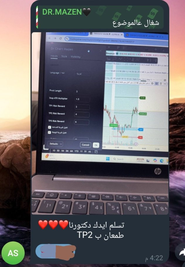 DCM_indicator's tweet photo. تسلم ايدك دكتورنا❤️❤️❤️ 
طمعان ب TP2 https://t.co/PzPZe0rY6L