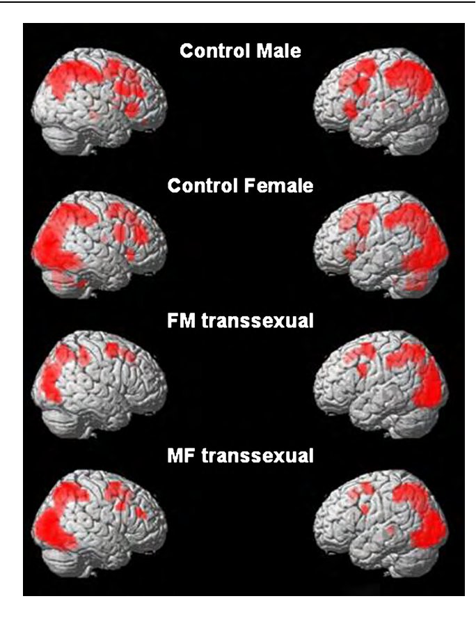 MrJohnSmithIIJR's tweet photo. @hihika545263 @Loyal_Samwise4 Except its literally not lmao
Tests have been run MULTIPLE times throughout the years all coming to the same conclusion 
Trans people are biologically programmed to be the other gender but are literally trapped in the wrong body 
Not an argument, just basic biology 🫶 https://t.co/UH0Esr8yHH