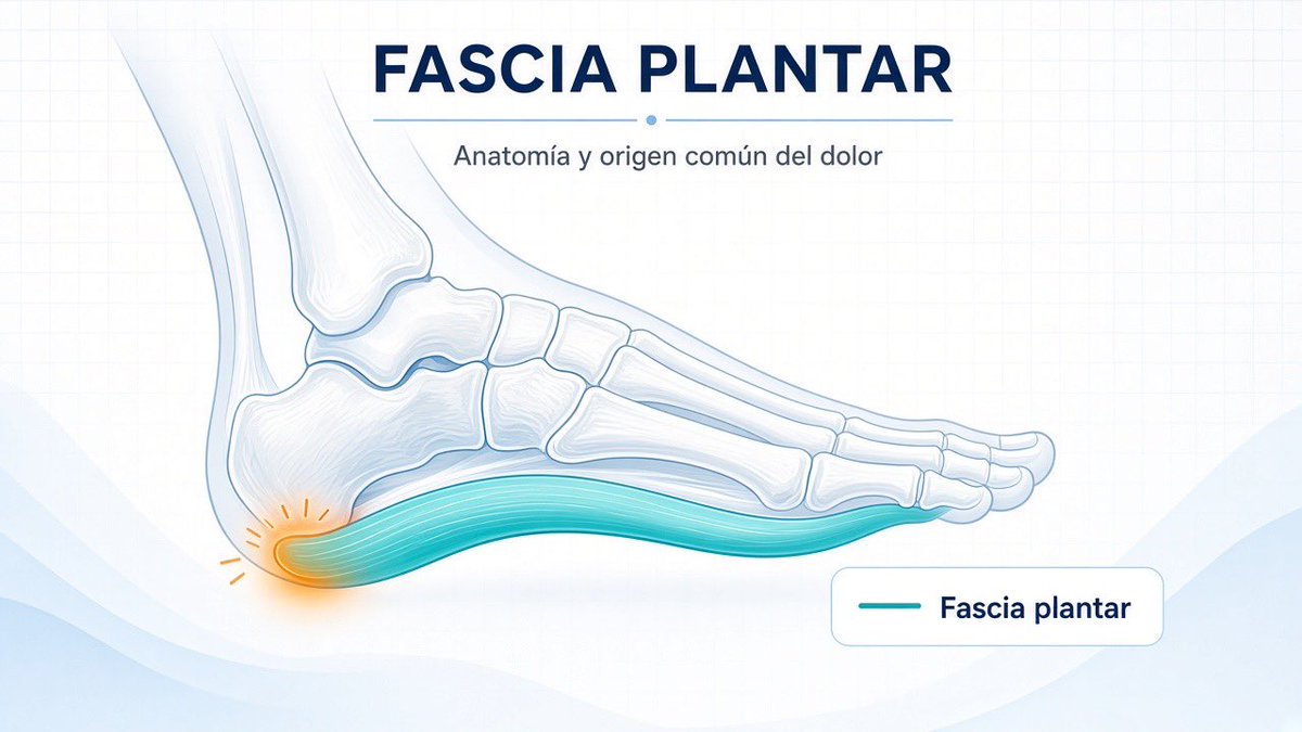 Dr_Sadun's tweet photo. ¿Dolor agudo en el talón al dar los primeros pasos de la mañana? Puede ser fascitis plantar. El calzado adecuado y una evaluación oportuna ayudan a recuperar la marcha sin forzar. #Pie
Agenda tu cita vía WhatsApp: +593 980 784 857 https://t.co/1WjuuAibOF