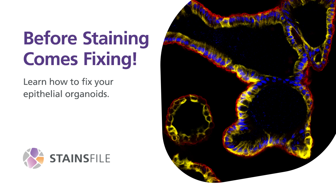 StainsFile's tweet photo. 😵‍💫 Flummoxed by fixation?

This protocol is optimized for whole-mount fixation of epithelial organoids for #immunostaining. It covers both dehydration and cross-linking methods for #ChemicalFixation, giving you more options with your samples: https://t.co/4XOeLFDySw https://t.co/U9ZPC2FS1X