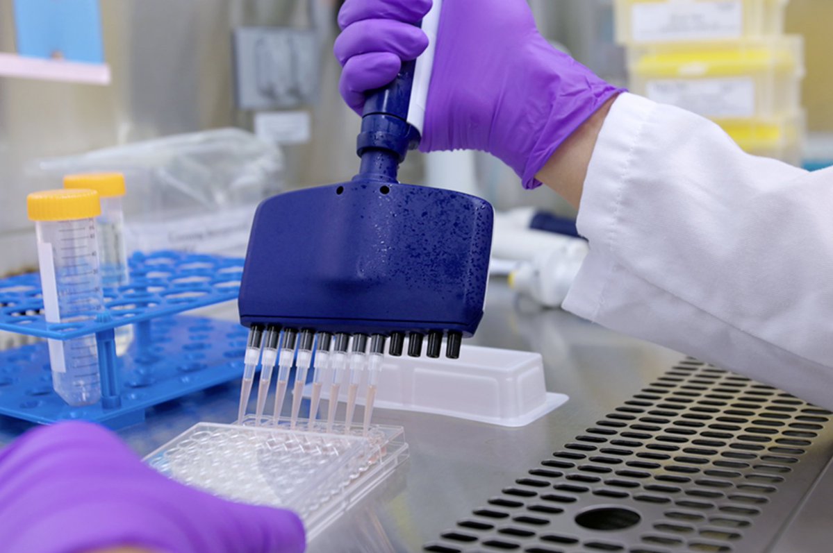 AUG_University's tweet photo. A team of researchers at the @ImmunologyAU identified five immune targets that may help explain how CD8+ T cells contribute to atherosclerosis. The findings could help advance research into targeted therapies for cardiovascular disease.
https://t.co/398CPbbMPy https://t.co/p14cP4mIyT