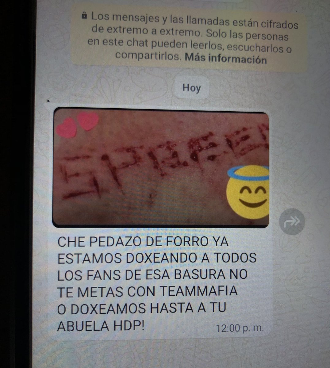 EmersonDuron4's tweet photo. @Altmond_10 Tengo miedo 😞 https://t.co/KBBRpjdiAi