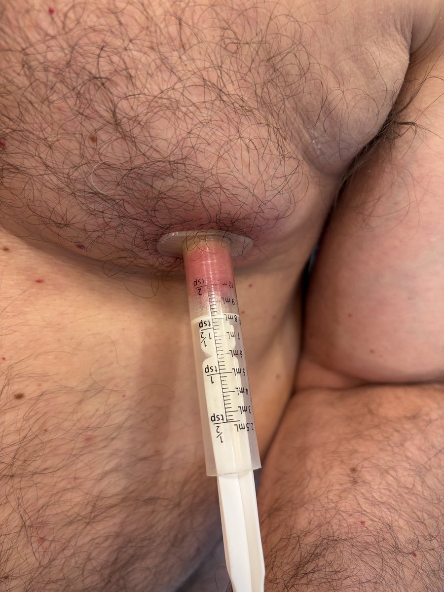 Richard01581270's tweet photo. Nipple stretching with suction. #nippleplay #nipplepumping #nipplestretching https://t.co/cl6dDmOiRV