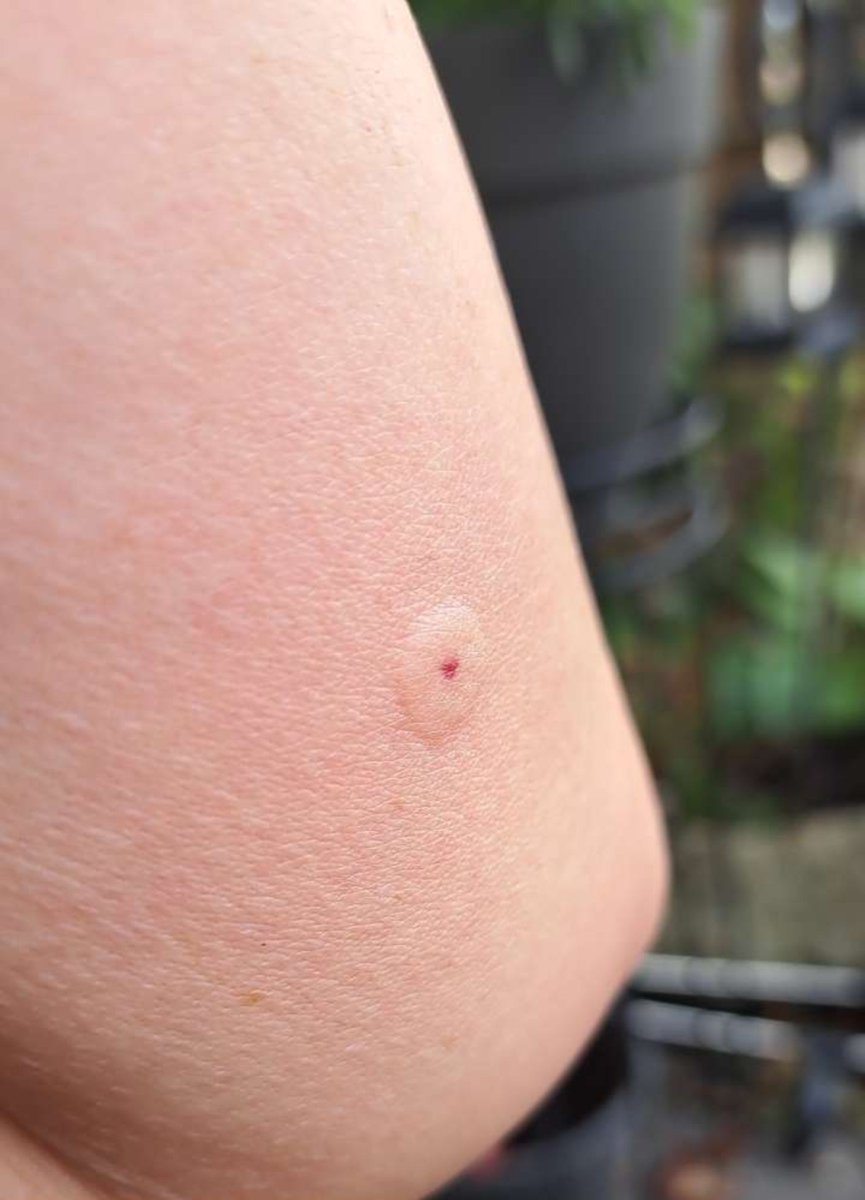 InkedDeviant's tweet photo. Working On Cleaning Up Our Front Gardens This Aft...
Something Got Me Good.
#ouch #thatsmarts #gardeninglife https://t.co/QNW1Tybkix