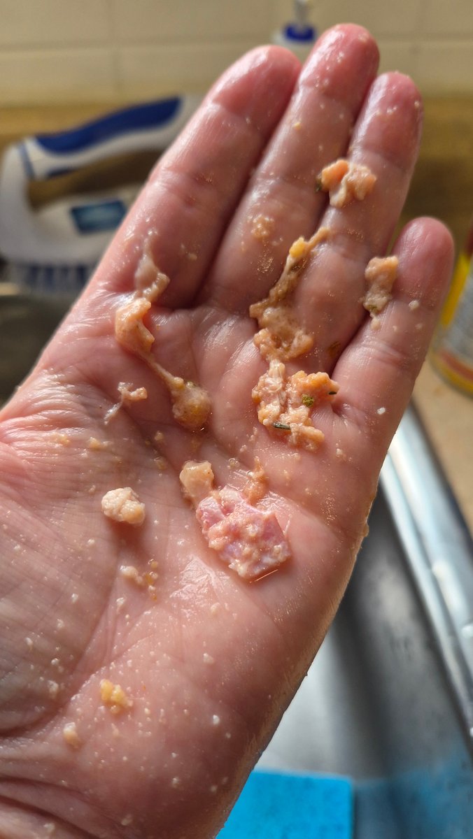 IngovilleWrites's tweet photo. @WalmartCanada what in the name of all things food safety are these mystery chunks and globs in the pack of hamburger I bought from you? I am NOT feeding this to my family! What. The. Hell.

DISGUSTING https://t.co/F0li4oXFfm