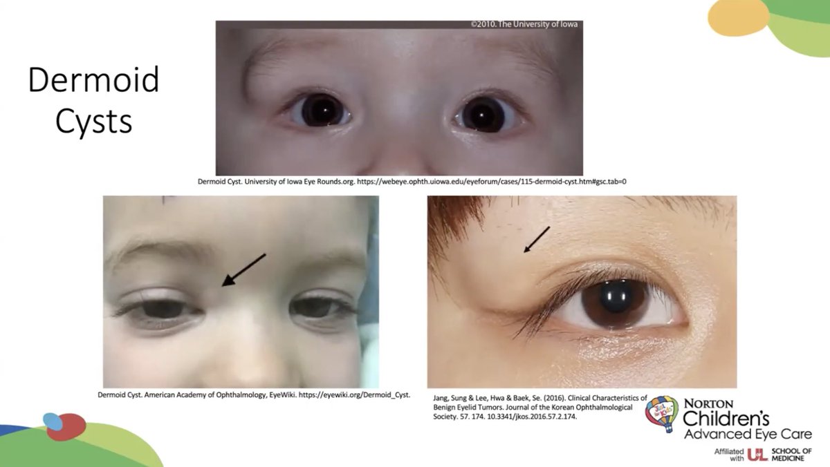 NCProvider's tweet photo. Missed our latest Updates in Pediatrics Online CME? Learn how to interpret failed vision screenings, recognize common pediatric eye findings &amp; understand key ophthalmology terminology with Nicole Jody, M.D.

Earn up to 1.0 AMA PRA Category 1 Credit™
🔗: https://t.co/XXOsIt6D8c https://t.co/sU1o6iO8Qz