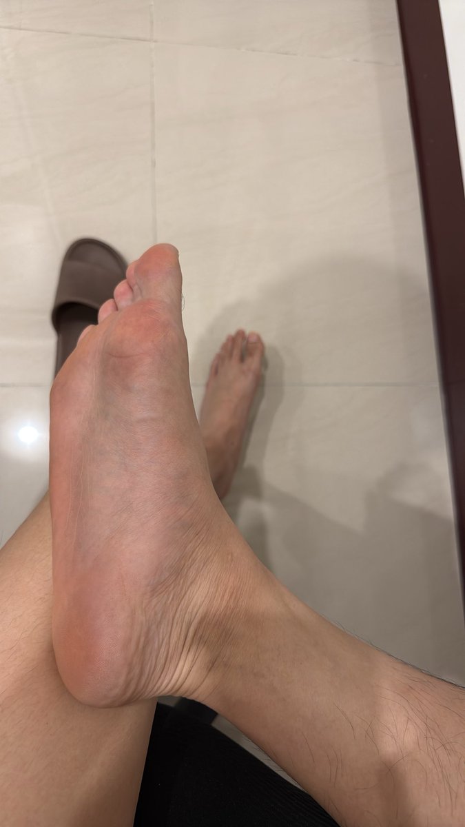 cylpgz666's tweet photo. 🦶 https://t.co/lR3hSevkdx