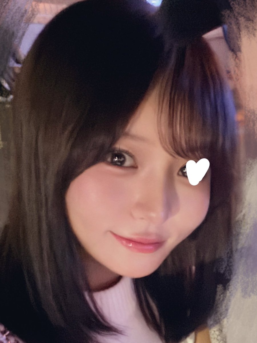 wj4616's tweet photo. ジャスト美容外科(@justprsjp )でデュアルピーチリフト施術してから2週間経った🍑

腫れ引いて施術した時の傷も分からなくなりましたჱ̒ ᴗ ̫ ᴗ

クマとほうれい線が目立ちにくくなったのと、とくに頬がのっぺりしてる感じが改善されてる！これ伝わるかなー😣

左上がbeforeで下がafter https://t.co/NxKLjjbOFC