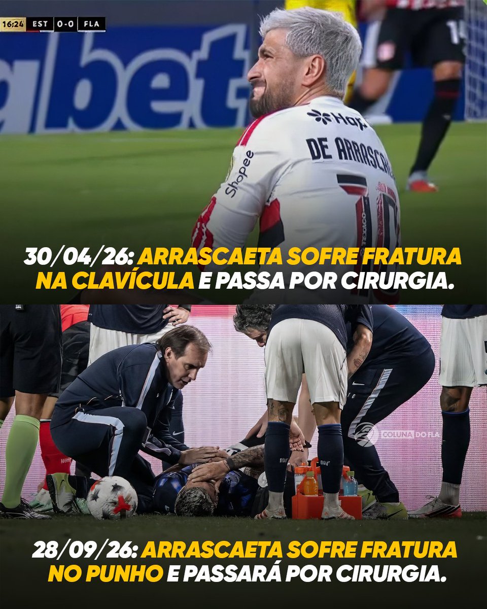 ColunadoFla's tweet photo. Não está sendo um ano fácil para Arrascaeta. 😔

Duas cirurgias em um intervalo de apenas cinco meses. https://t.co/0DaEMryPmL