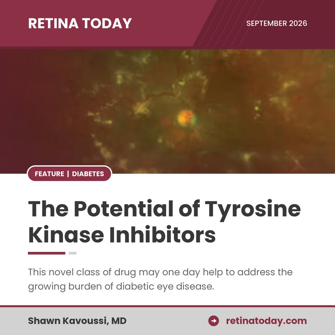 RetinaToday's tweet photo. Up to 35% of patients with DME gained fewer than 5 letters at 12 weeks on monthly aflibercept 2 mg in the Protocol T early analysis. Where could TKIs fit? https://t.co/kwZRON2kpC
 #Ophthalmology https://t.co/P01PJ7SYMf