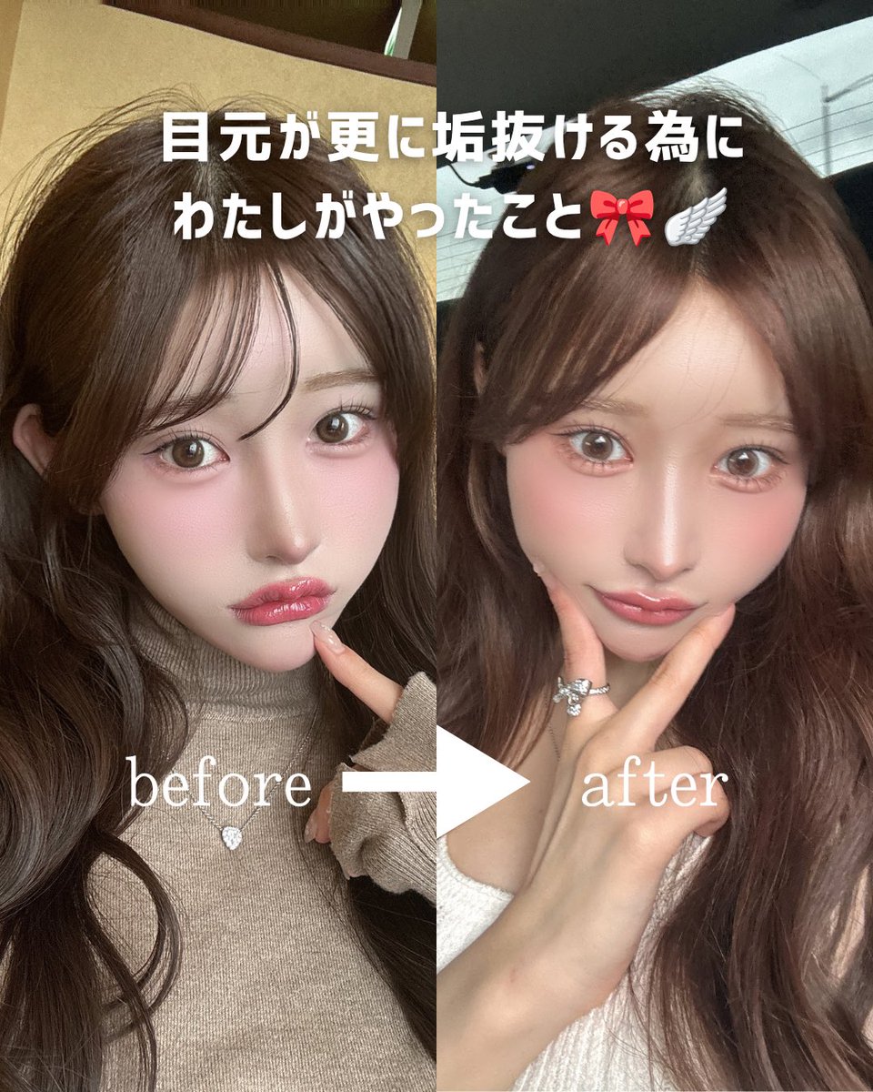 dr_maruyama's tweet photo. 【目頭切開で垢抜け？！】
目頭切開リドレープ法
モニター価格198,000円 https://t.co/03R44hdhgC
