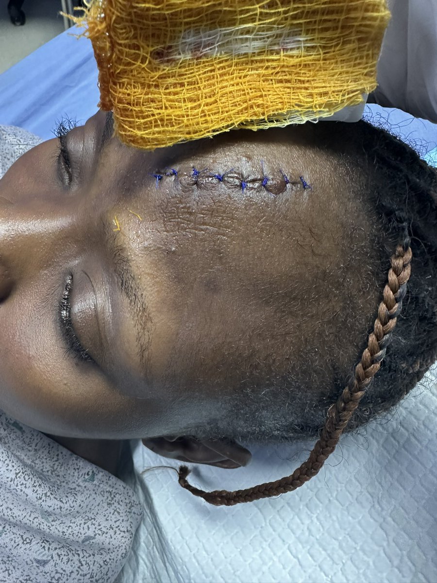 symplyseun's tweet photo. @inDrive it’s been over 24hrs!!!!!!
3 emails later and NO positive response on holding your driver accountable for the damage he caused my friend and I.

My head was fucking stitched!!!! My friend hit her head and strained her legs and y’all are asking me redundant questions about the drivers detail that I already provided.

There’s been no word from the driver in over 24hrs!!! We’ve been in pain and no single tangible statement from you guys yet. I WILL NOT REST!!! Not until y’all take responsibility for this, pay for damages and all our hospital expenses. Also, that driver has to take responsibility for the pain he has caused us. 

I WILL NOT REST @inDrive