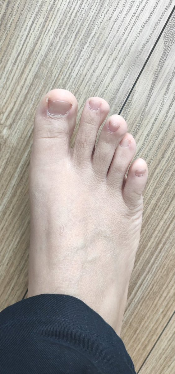 memorandumest's tweet photo. 老师的脚 https://t.co/ziUGKNh7Zv