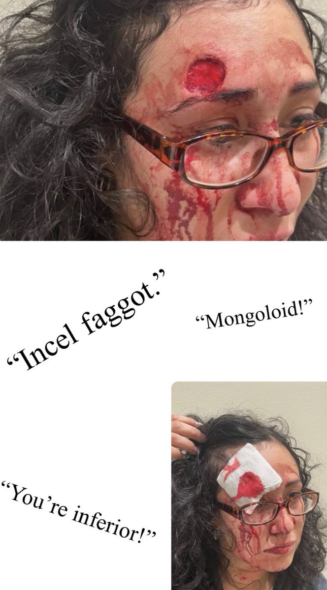 choeshow's tweet photo. SEATTLE CANNIBAL: Kamilia Chadli is being arraigned today for allegedly biting off a piece of Diana Gonzalez’s forehead in an unprovoked attack just a block away from City Hall. 
Cops say Chadli is a Black woman who yelled homophobic slurs at Gonzalez and referred to her Hispanic ethnicity. 
But she’s only being charged with 2nd degree assault instead of a hate crime. 
Meanwhile, I’m now looking into Chadli’s background. 
To no one’s surprise, she claims to be a resident of the Downtown Emergency Service Center on 619 3rd Ave. 
DESC is a Housing First hell hole that triggers the most 911 calls in the area.
Socialist Seattle Mayor Katie Wilson has endorsed this model as a solution for the city’s out of control homeless drug crisis. 
Yet open air fentanyl use, severely mentally ill residents, and convicted felons living inside these facilities continue to spill out into the community and cause chaos. 🧵👇🏽
@DESCSeattle|@MayorofSeattle