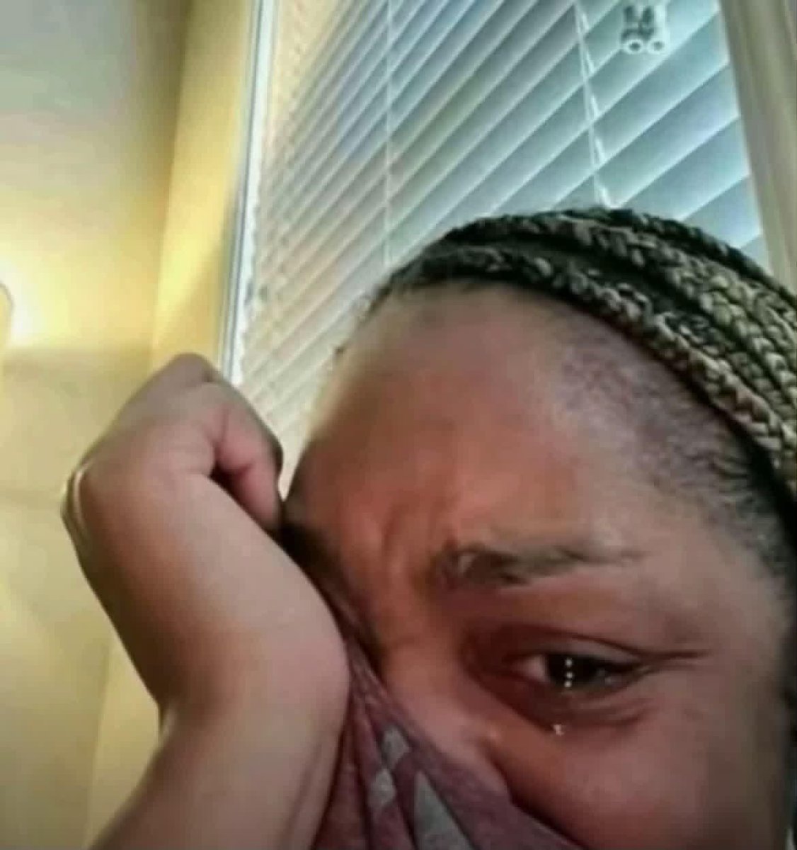 softly3against's tweet photo. My vitiligo is progressing so quickly now. I DON’T WANT TO BE WHITE. https://t.co/sj0uPT6Q7t