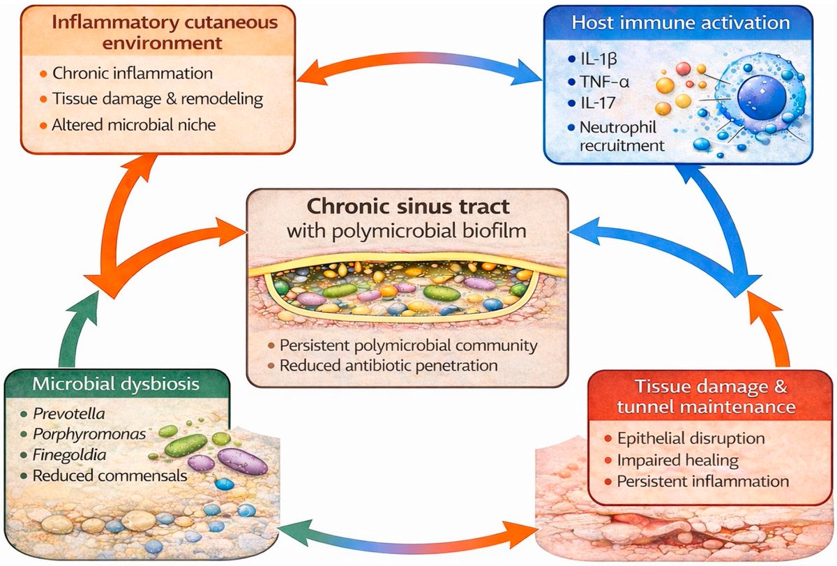 mdpi_dermato's tweet photo. 🦠 Read in #DermatoMDPI:

"The Skin Microbiome in Hidradenitis Suppurativa: Pathogenic Insights, Therapeutic Implications, and Future Directions"

By Jia Qi Adam Bai and Ilya Mukovozov

📖 https://t.co/aqBHFrUgbb

#HidradenitisSuppurativa #SkinMicrobiome #Microbiome #Dermatology https://t.co/bgj4KJAx11