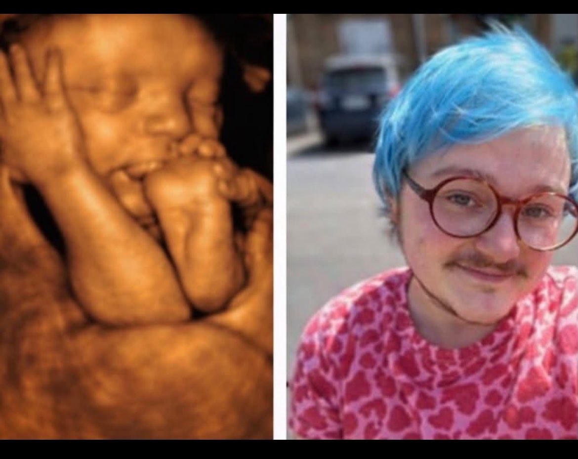 Rosadicos's tweet photo. Imagina lo masiva y costosa que debe haber sido la propaganda para convencer a los jóvenes de que el de la izquierda “no es un niño” y el de la derecha “es una mujer”, y que decir la verdad es discurso de odio. https://t.co/04qwdSOZhx