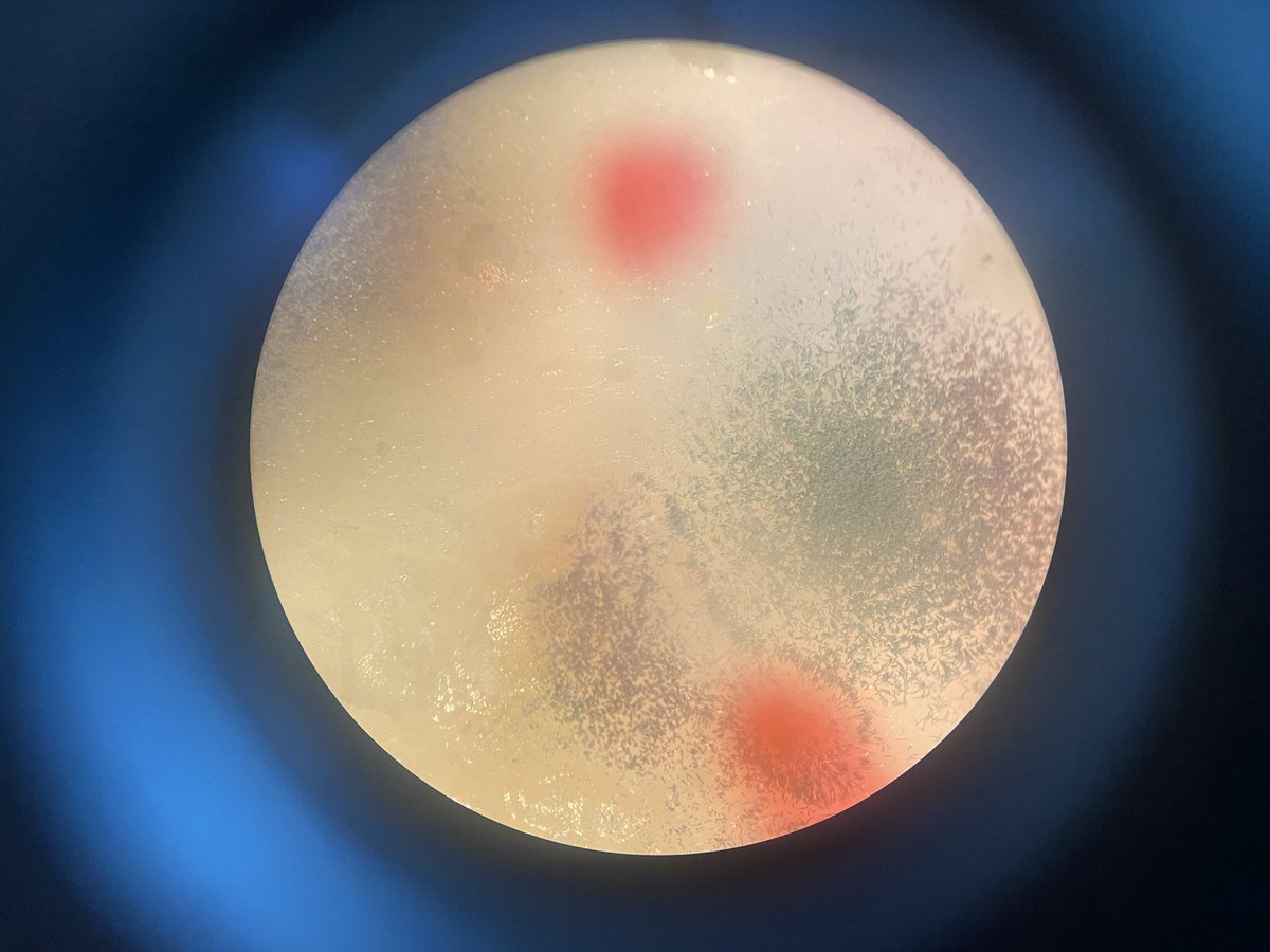 leesan_lol's tweet photo. My bacteria btw https://t.co/p155nNTfxN