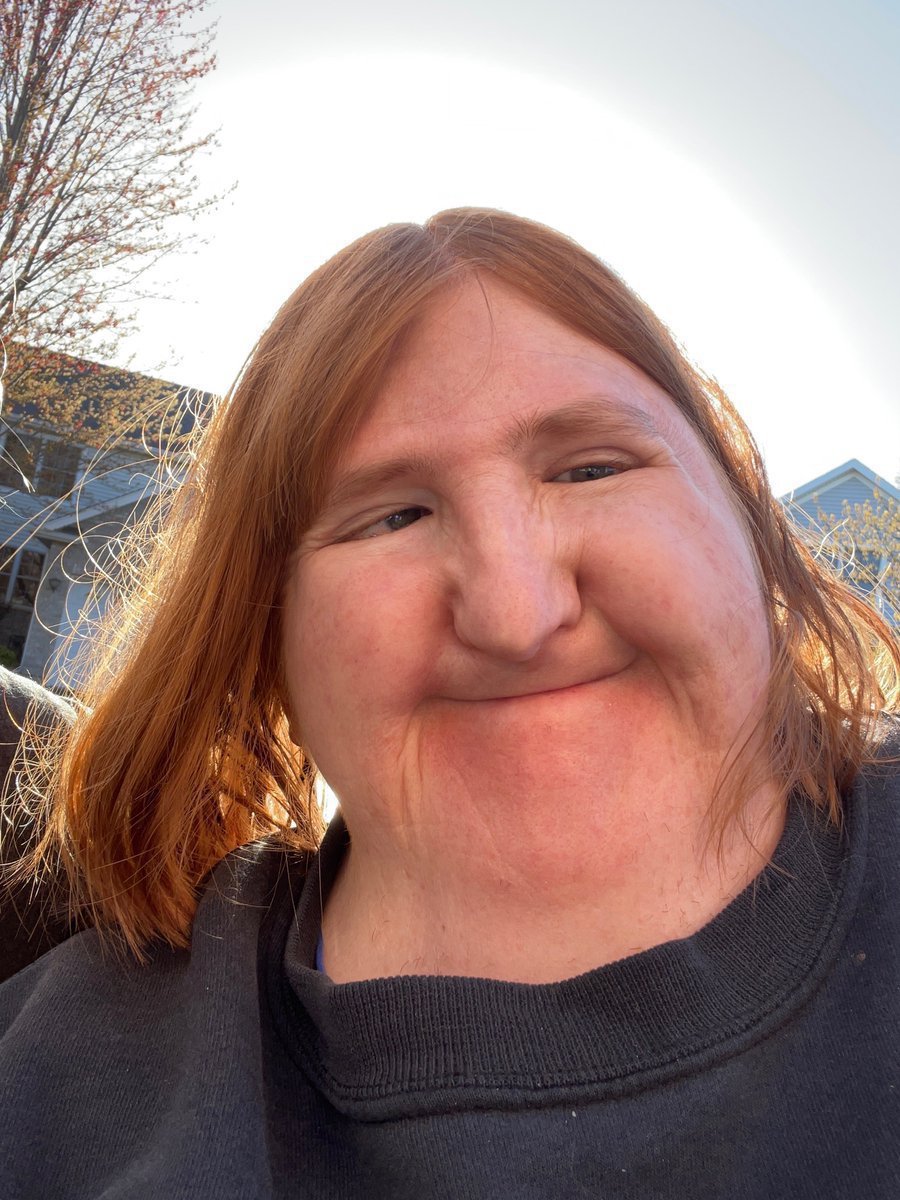 Isabella_x10's tweet photo. Yes, I may not be society’s definition of beautiful, but that doesn’t mean I’m not beautiful.

I am beautiful.

Disabled AND beautiful. 💋💕♿️ https://t.co/YQwlIbOkrv