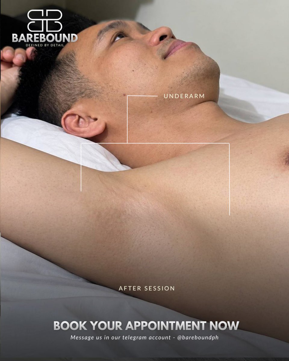 Bareboundph's tweet photo. Smooth underarms just hit different.
No more unwanted hair, no more shaving every few days โ just clean, smooth, and fresh underarms.
Ready to get yours smooth? Send us a message to book! ๐ค
#BareboundPH #UnderarmWaxing #SmoothUnderarms #WaxingPH #MensGroomingPH https://t.co/viuOwbf3cj