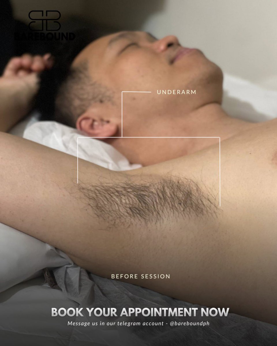 Bareboundph's tweet photo. Smooth underarms just hit different.
No more unwanted hair, no more shaving every few days โ just clean, smooth, and fresh underarms.
Ready to get yours smooth? Send us a message to book! ๐ค
#BareboundPH #UnderarmWaxing #SmoothUnderarms #WaxingPH #MensGroomingPH https://t.co/viuOwbf3cj