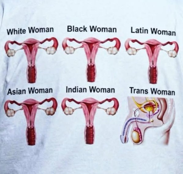 emocionycambio's tweet photo. The magazine’s readership is autogynephilic, pro-trans, and has so much pent-up frustration that they dream of being #TransXX (posing as a woman), despite the 500 photos and 100 issues I. A
She is and will always be a #woman; she thought the #transCult would make her famous, but in the end, neither before, just as she was, nor now, just as she remains, has she achieved ANYTHING. This whole horrible business is truly deplorable.
#StopTransCult she is a Woman ♀️