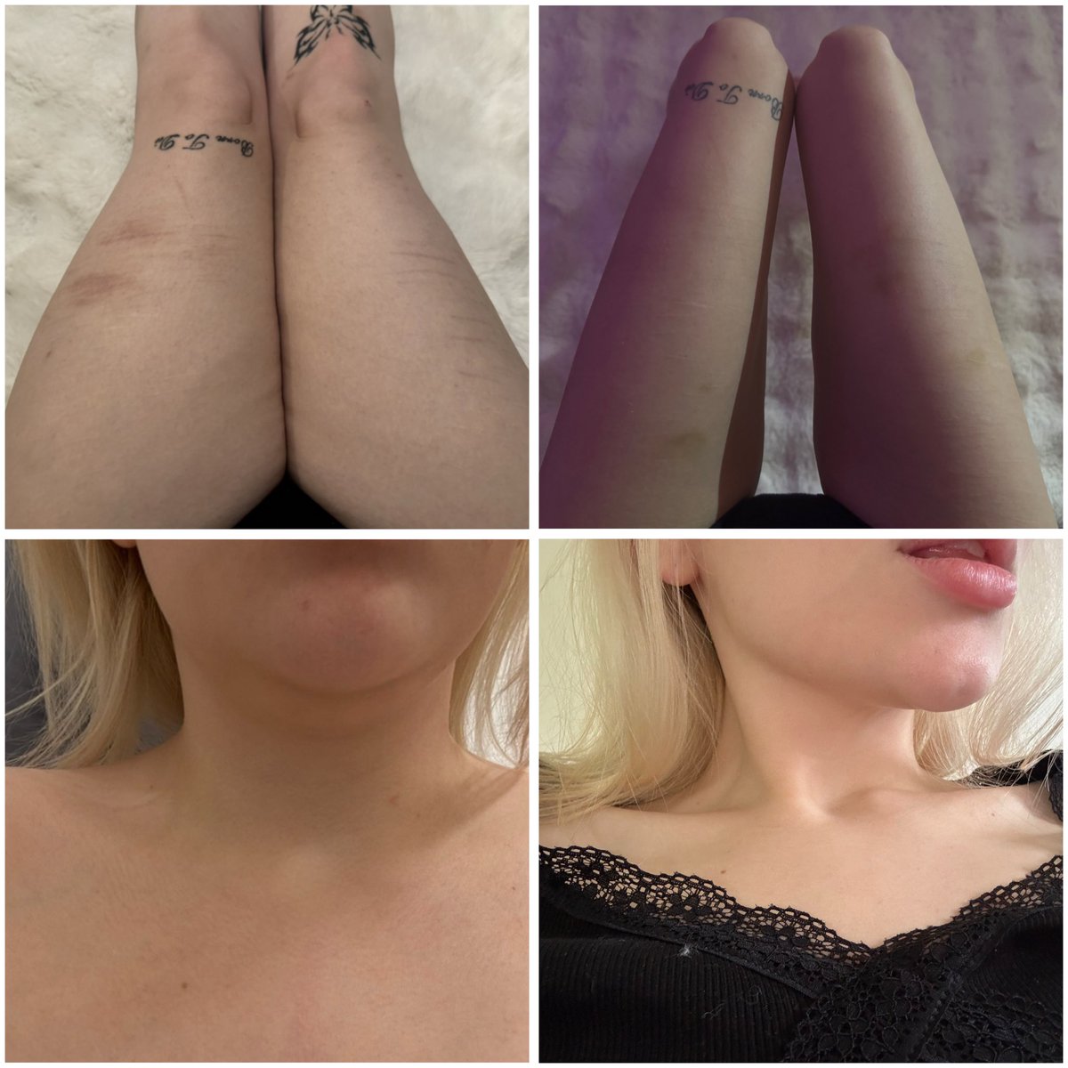 VanillaCodeine's tweet photo. tw: edtwt (is it edrtwt now?) bodycheck 

135lbs (bmi 25.5) - 98lbs (bmi 18.5)

gonna be posting how I lost the weight soon, im currently in the middle of moving so apologies for not being that active https://t.co/isyDtFDCqh