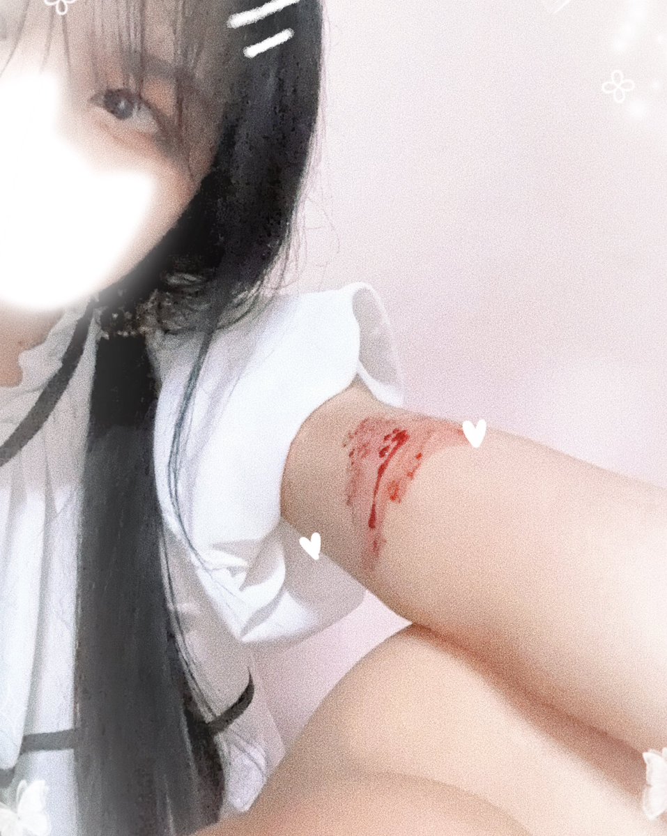 Chichichun_nn's tweet photo. もう死んでいいかな

SFX makeup 
Fake blood 
Not real https://t.co/zs1g9An1YF