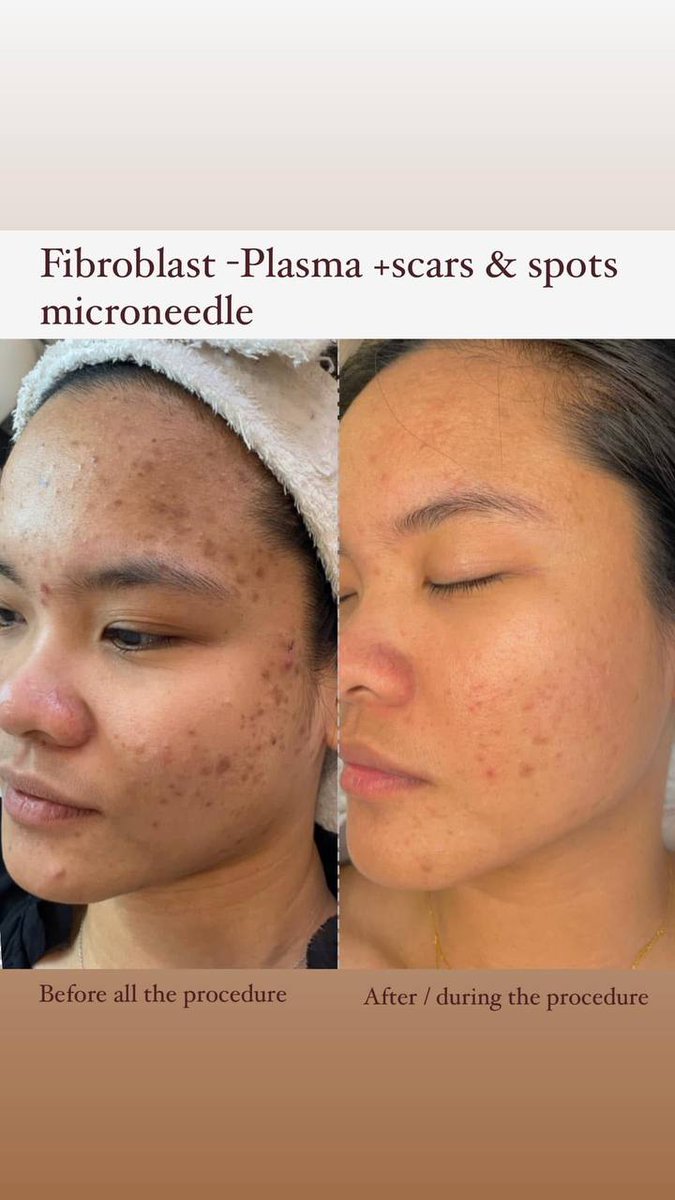 CindyColeman25's tweet photo. Through scientific skincare methods we improve the condition of your skin restoring its health firmness and radiance. 🌿
#ProfessionalBeauty #SkinCare #BeautyRegimen #SkinRejuvenation #BeautifulTransformation https://t.co/YnhaWI0IBg