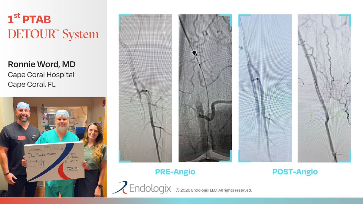 RheveraMedical's tweet photo. From observer to operator. Congratulations to Ronnie Word, MD, on his first #PTAB with the #DETOURSystem. Dr. Word attended an intensive DETOUR Centers of Excellence training in August and has now put that training into practice, delivering a fantastic revascularization result in his inaugural case.

Learn about the DETOUR System here: https://t.co/ycFuGmcK9i

@Lee_Health #healthcareinnovation #cardiotwitter #medicalinnovation #medtwitter #IRad #interventionalradiology
