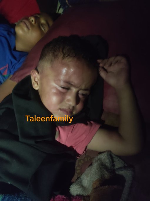 A young child appears to be sleeping with what looks like an injury or mark near their eye, with another person lying beside them; the image has an orange watermark reading "Taleenfamily".