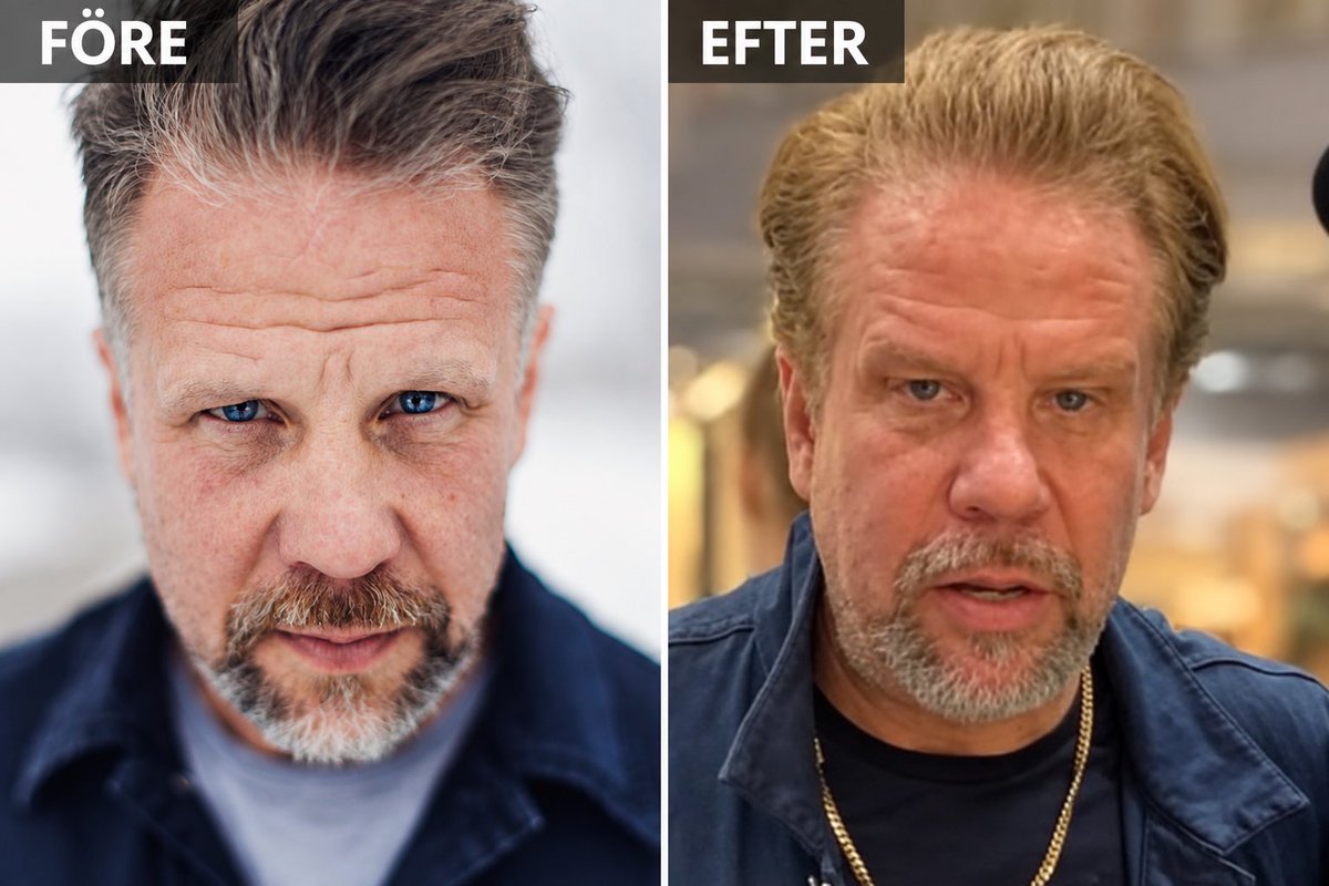 PelleWiman's tweet photo. Botox-klinken på hörnet: just nu 50% rabatt! https://t.co/eaP75Lho21