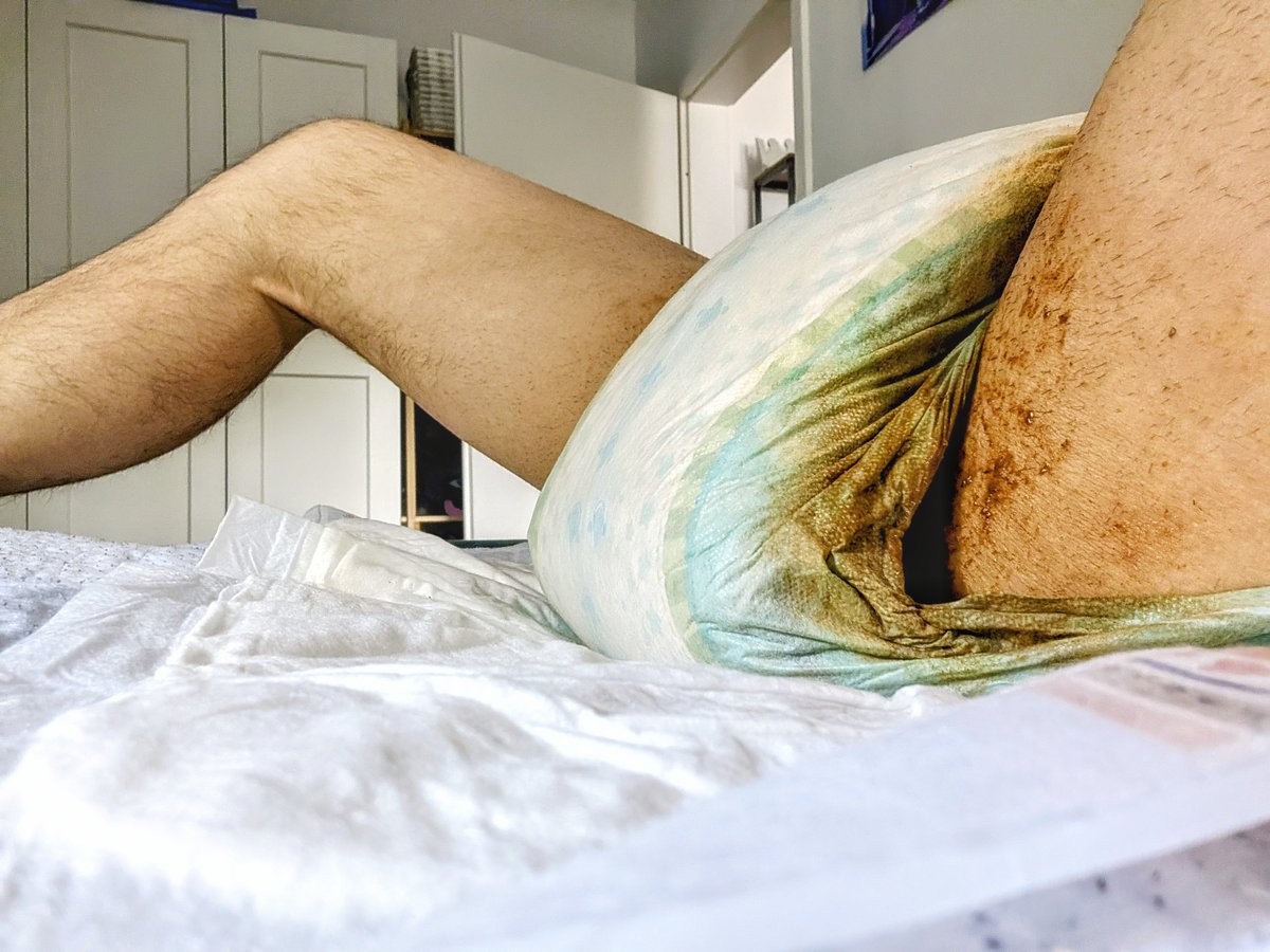 PinchyPup's tweet photo. Here's my entry for #messymonday 🙈
Have I passed ?
.
#diapers #messydiapers #diapermess #diaperpoop #diaperscat #diaperkink https://t.co/texmExCr2o
