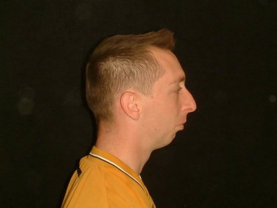 Jonnylji6's tweet photo. @ddraculia @katfiniti @soartdeco11 @foahmolly Last one to talk about side profiles 😭 https://t.co/91wP5Ott9b