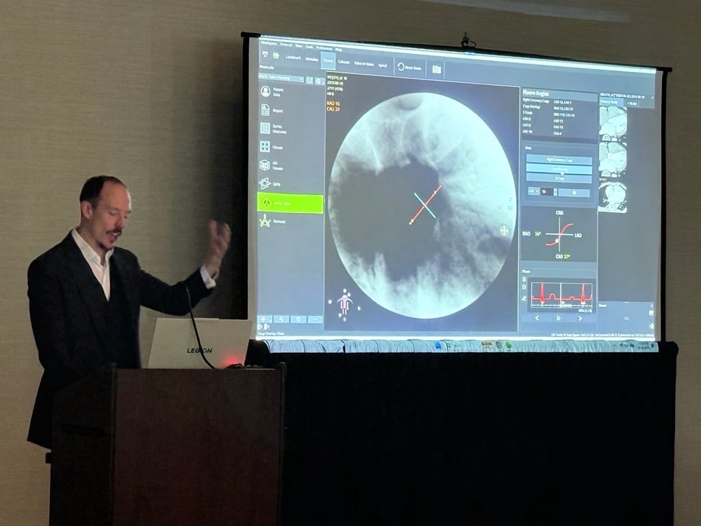 circlecvi's tweet photo. We’re grateful to be part of today’s NASCI TAVR Workshop and the discussion with clinicians and imaging leaders advancing cardiovascular care.
#NASCI26 #TAVR #CardiovascularImaging #Cardiology https://t.co/15TKMdNMnV