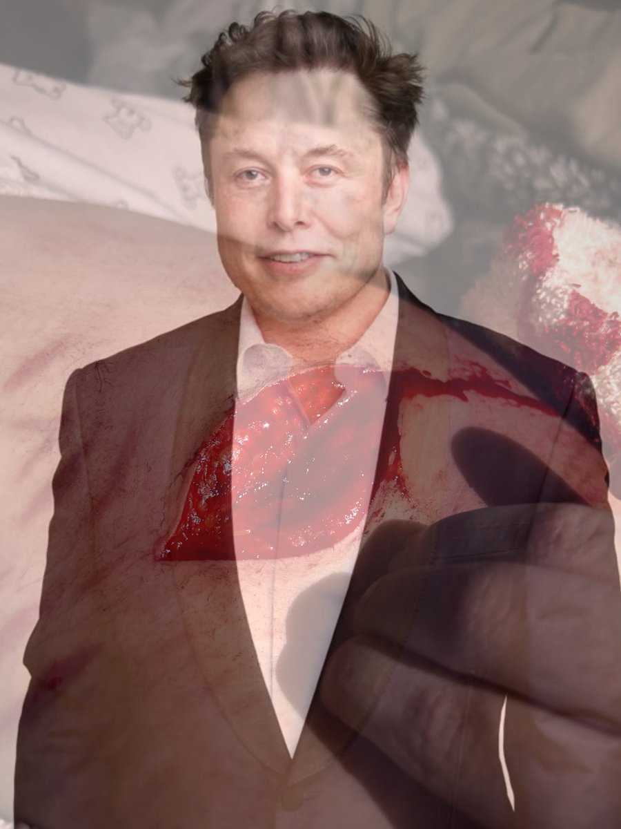 dysfiguredd's tweet photo. omg elon why would u do that to urself pls ttm im here for u

fake sfx wounds on elon for ellens reality tv show https://t.co/VjZxNGXc8k