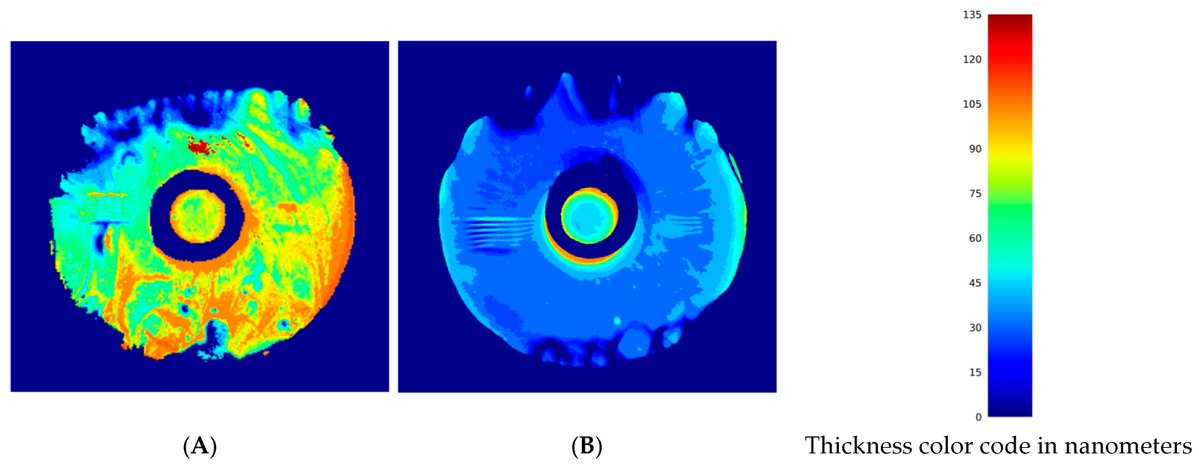 revoptom's tweet photo. Novel Tear Film Imager Reveals Lipid Layer Abnormalities in Sjögren’s Dry Eye
The investigational, non-FDA-approved device detected uneven distribution in these patients vs. controls, pointing toward meibomian involvement.
https://t.co/HnEXiPZsgi
#dryeye #dryeyedisease https://t.co/x22gbfv347